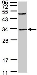 Western blot - Anti-PEF1 antibody (AB96132), expandable thumbnail