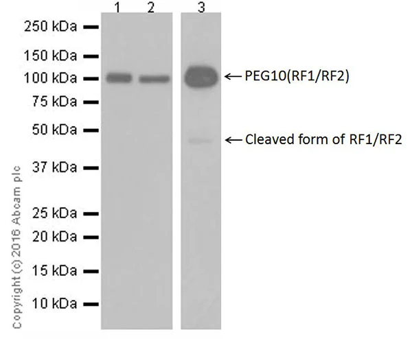 Western blot - Anti-PEG10/EDR antibody [EPR20051] (AB215035)