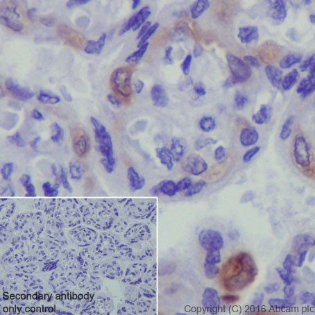 Immunohistochemistry (Formalin/PFA-fixed paraffin-embedded sections) - Anti-PEG10/EDR antibody [EPR20051] - BSA and Azide free (AB240392), expandable thumbnail