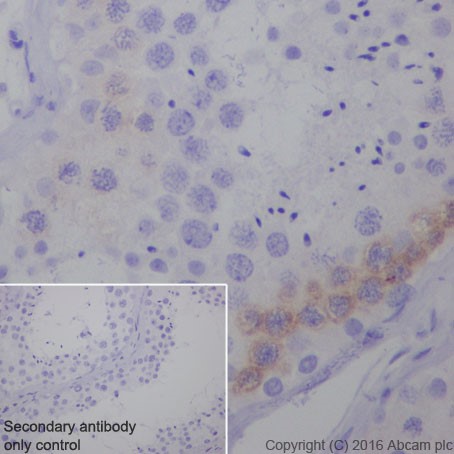 Immunohistochemistry (Formalin/PFA-fixed paraffin-embedded sections) - Anti-PEG10/EDR antibody [EPR20051] - BSA and Azide free (ab240392), expandable thumbnail