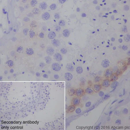 Immunohistochemistry (Formalin/PFA-fixed paraffin-embedded sections) - Anti-PEG10/EDR antibody [EPR20051] - BSA and Azide free (AB240392)