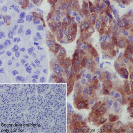 Immunohistochemistry (Formalin/PFA-fixed paraffin-embedded sections) - Anti-PEG10/EDR antibody [EPR20051] - BSA and Azide free (AB240392), expandable thumbnail