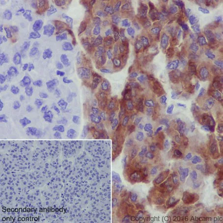Immunohistochemistry (Formalin/PFA-fixed paraffin-embedded sections) - Anti-PEG10/EDR antibody [EPR20051] - BSA and Azide free (AB240392)