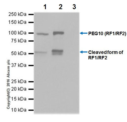 Immunoprecipitation - Anti-PEG10/EDR antibody [EPR20051] - BSA and Azide free (ab240392), expandable thumbnail