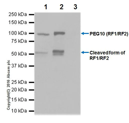 Immunoprecipitation - Anti-PEG10/EDR antibody [EPR20051] - BSA and Azide free (AB240392)