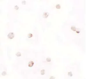 Immunocytochemistry - Anti-Pellino 1 antibody - C-terminal (AB189953)