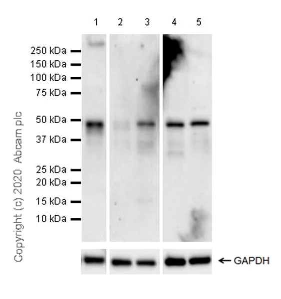 Western blot - Anti-Pellino 1 + Pellino 2 antibody [EPR23275-22] (AB254297)