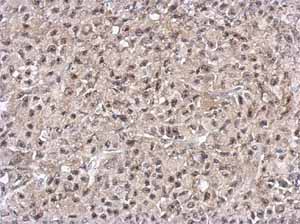Immunohistochemistry (Formalin/PFA-fixed paraffin-embedded sections) - Anti-PELO antibody (AB154335)