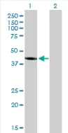 Western blot - Anti-PELO antibody (AB88673)
