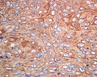 Immunohistochemistry (Formalin/PFA-fixed paraffin-embedded sections) - Anti-PELO antibody [EP7530] (AB140615)