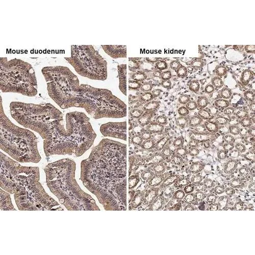 Immunohistochemistry (Formalin/PFA-fixed paraffin-embedded sections) - Anti-PELO antibody [HL2345] (AB317204)