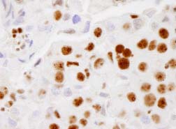 Immunohistochemistry (Formalin/PFA-fixed paraffin-embedded sections) - Anti-PELP1 antibody (AB84094)