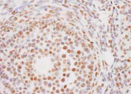 Immunohistochemistry (Formalin/PFA-fixed paraffin-embedded sections) - Anti-PELP1 antibody (AB84094)