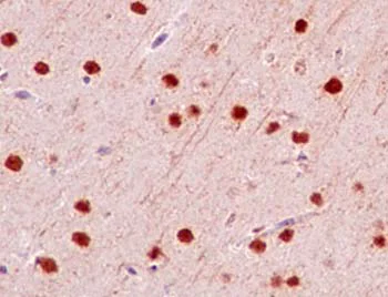 Immunohistochemistry (Formalin/PFA-fixed paraffin-embedded sections) - Anti-PELP1 antibody [EPR15212] (AB187653)