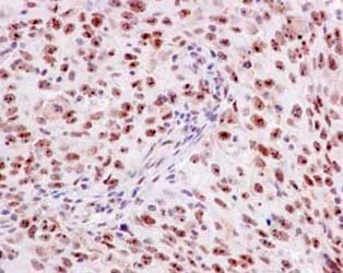 Immunohistochemistry (Formalin/PFA-fixed paraffin-embedded sections) - Anti-PELP1 antibody [EPR15212] - BSA and Azide free (AB250932)