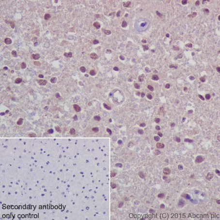 Immunohistochemistry (Formalin/PFA-fixed paraffin-embedded sections) - Anti-PELP1 antibody [EPR15213] (AB200203)
