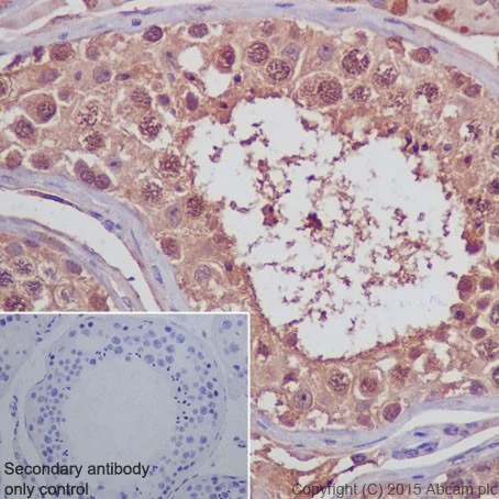 Immunohistochemistry (Formalin/PFA-fixed paraffin-embedded sections) - Anti-PELP1 antibody [EPR15213] (AB200203)