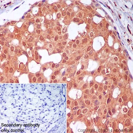 Immunohistochemistry (Formalin/PFA-fixed paraffin-embedded sections) - Anti-PELP1 antibody [EPR15213] (AB200203)