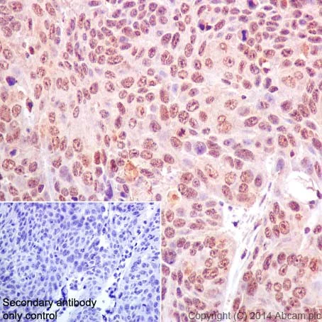 Immunohistochemistry (Formalin/PFA-fixed paraffin-embedded sections) - Anti-PELP1 antibody [EPR15213] - BSA and Azide free (AB251303)