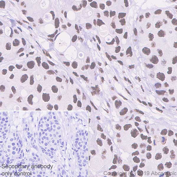 Immunohistochemistry (Formalin/PFA-fixed paraffin-embedded sections) - Anti-PELP1 antibody [EPR22864-62] (AB256488), expandable thumbnail