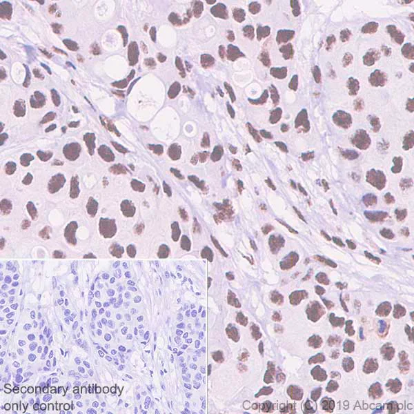 Immunohistochemistry (Formalin/PFA-fixed paraffin-embedded sections) - Anti-PELP1 antibody [EPR22864-62] (AB256488)