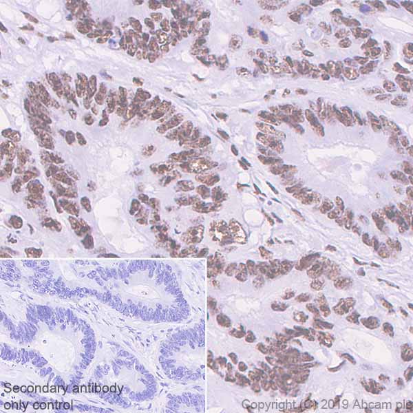 Immunohistochemistry (Formalin/PFA-fixed paraffin-embedded sections) - Anti-PELP1 antibody [EPR22864-62] (AB256488), expandable thumbnail
