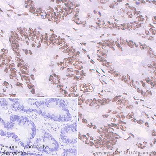 Immunohistochemistry (Formalin/PFA-fixed paraffin-embedded sections) - Anti-PELP1 antibody [EPR22864-62] - BSA and Azide free (AB256825)