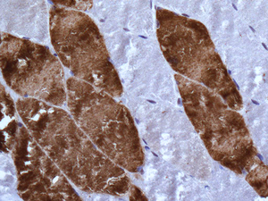 Immunohistochemistry (Formalin/PFA-fixed paraffin-embedded sections) - Anti-PEN2 antibody [EPR9200] (AB154830), expandable thumbnail