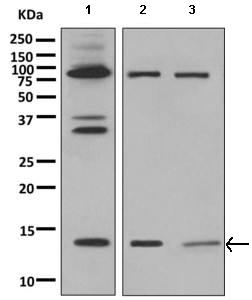 Western blot - Anti-PEN2 antibody [EPR9200] (AB154830), expandable thumbnail