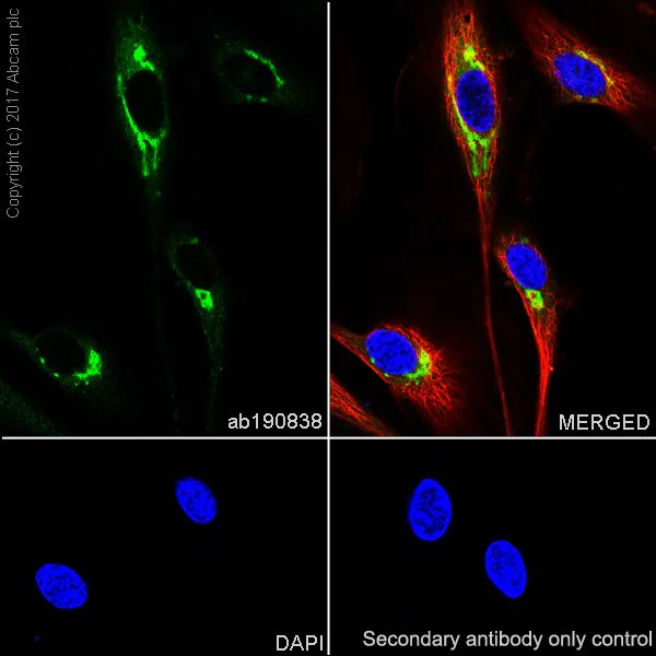 Immunocytochemistry/ Immunofluorescence - Anti-Pentraxin 3/PTX3 antibody [EPR18678-105] (AB190838)