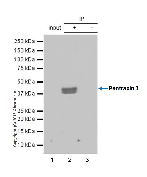 Immunoprecipitation - Anti-Pentraxin 3/PTX3 antibody [EPR18678-105] (AB190838)