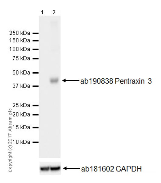 Anti-Pentraxin 3/PTX3 antibody [EPR18678-105] (ab190838) | Abcam