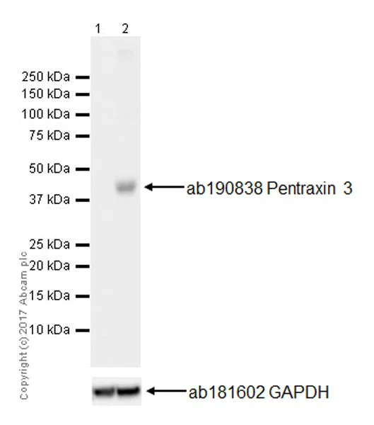 Western blot - Anti-Pentraxin 3/PTX3 antibody [EPR18678-105] (AB190838)