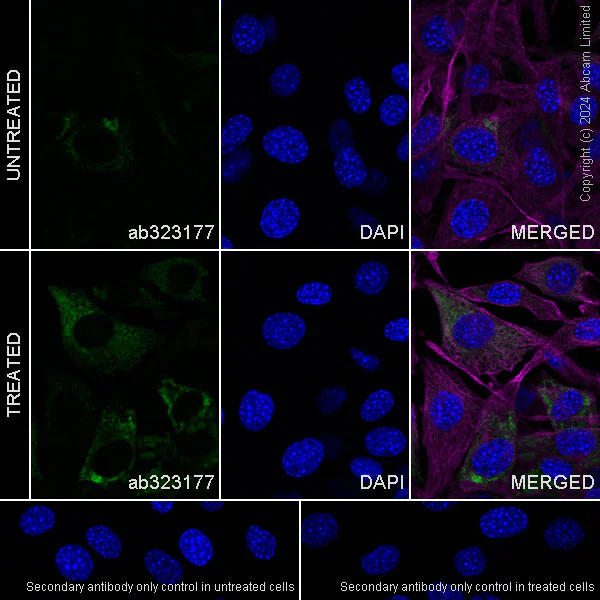 Immunocytochemistry/ Immunofluorescence - Anti-Pentraxin 3/PTX3 antibody [EPR22094-19] (AB323177)