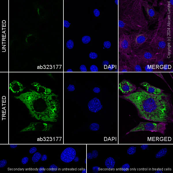 Immunocytochemistry/ Immunofluorescence - Anti-Pentraxin 3/PTX3 antibody [EPR22094-19] (AB323177)