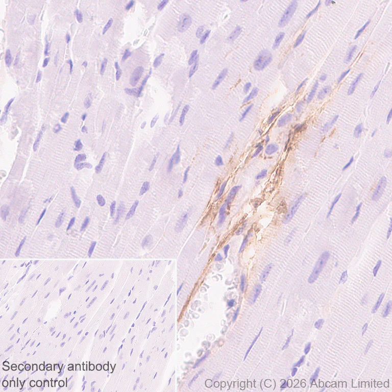 Immunohistochemistry (Formalin/PFA-fixed paraffin-embedded sections) - Anti-Pentraxin 3/PTX3 antibody [EPR30744-540] (AB325639)