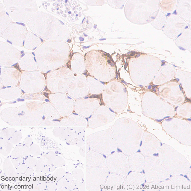 Immunohistochemistry (Formalin/PFA-fixed paraffin-embedded sections) - Anti-Pentraxin 3/PTX3 antibody [EPR30744-540] (AB325639)