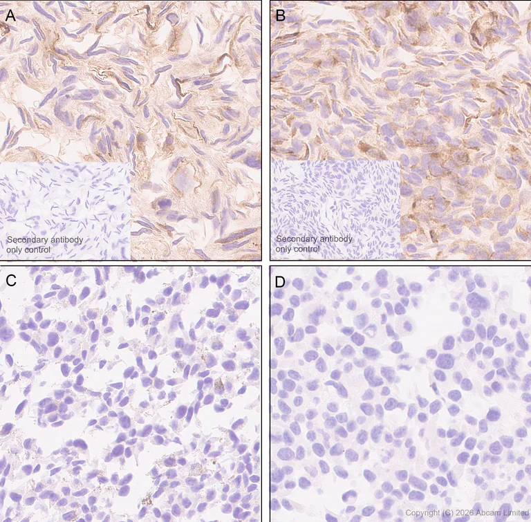 Immunohistochemistry (Formalin/PFA-fixed paraffin-embedded sections) - Anti-Pentraxin 3/PTX3 antibody [EPR30744-540] (AB325639)
