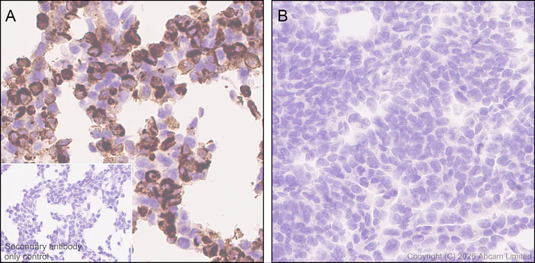 Immunohistochemistry (Formalin/PFA-fixed paraffin-embedded sections) - Anti-Pentraxin 3/PTX3 antibody [EPR30744-540] (AB325639)
