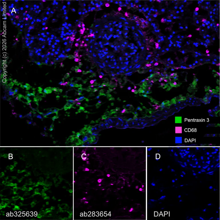 Multiplex immunohistochemistry - Anti-Pentraxin 3/PTX3 antibody [EPR30744-540] (AB325639)