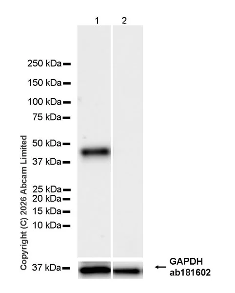 Western blot - Anti-Pentraxin 3/PTX3 antibody [EPR30744-540] (AB325639)