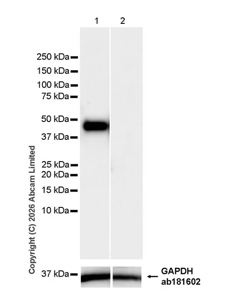 Western blot - Anti-Pentraxin 3/PTX3 antibody [EPR30744-540] (AB325639)