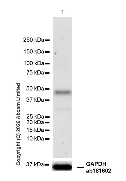 Western blot - Anti-Pentraxin 3/PTX3 antibody [EPR30744-540] (AB325639)