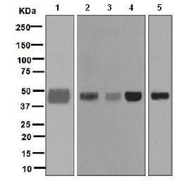 Western blot - Anti-Pentraxin 3/PTX3 antibody [EPR6699] (AB125007), expandable thumbnail