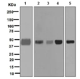 Western blot - Anti-Pentraxin 3/PTX3 antibody [EPR6699] (AB125007)