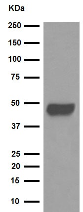 Western blot - Anti-Pentraxin 3/PTX3 antibody [EPR6699] (AB125007), expandable thumbnail