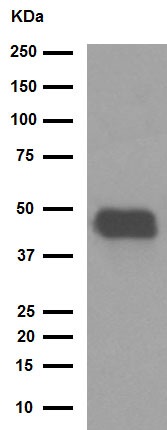 Western blot - Anti-Pentraxin 3/PTX3 antibody [EPR6699] (AB125007), expandable thumbnail