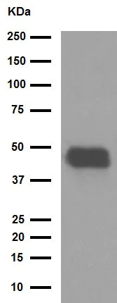 Western blot - Anti-Pentraxin 3/PTX3 antibody [EPR6699] (AB125007)