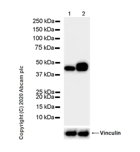 Western blot - Anti-Pentraxin 3/PTX3 antibody [MNB1] (AB90806)