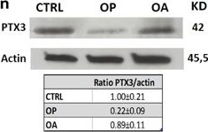 Western blot - Anti-Pentraxin 3/PTX3 antibody [MNB1] (AB90806), expandable thumbnail